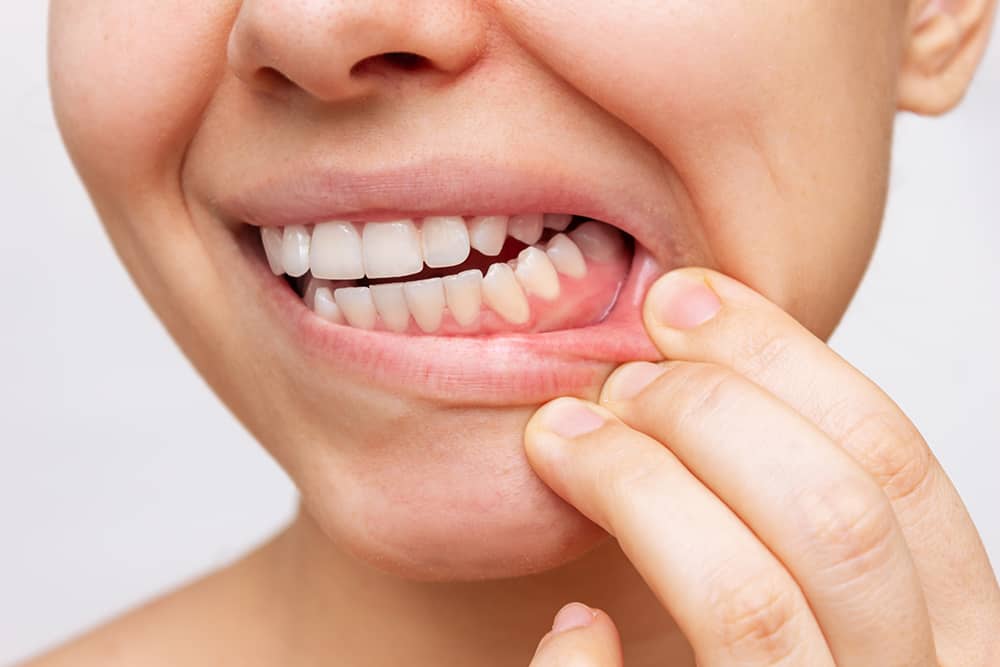 Sensibilidad dental: causas principales y soluciones