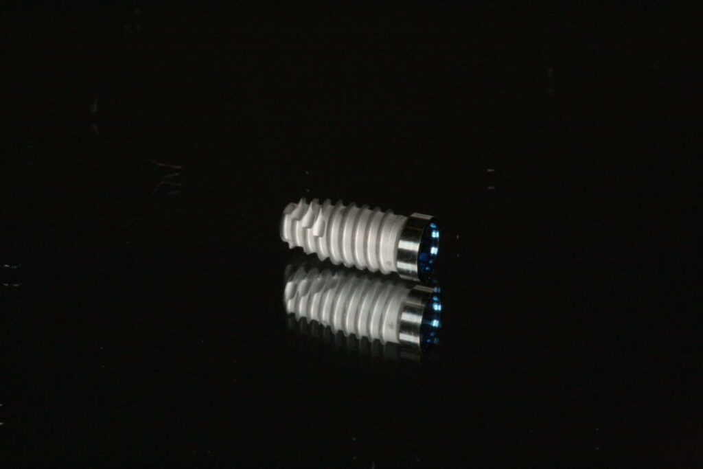 foto-implante-1030x687